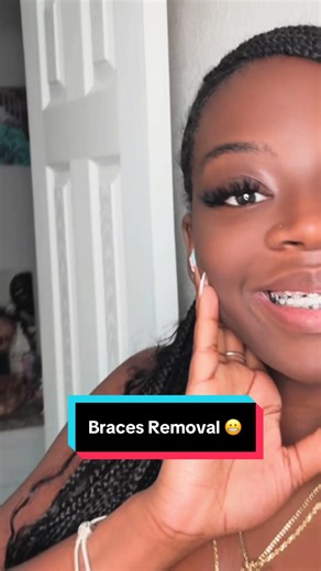 Braces Removal Journey: Last Day as a Braceface 😬