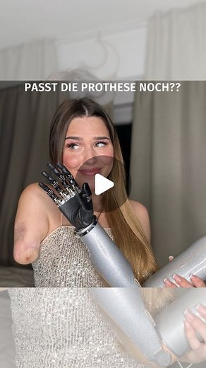 Die Einarmige Prinzessin on Instagram: "Der Moment - passt die Prothese nach der Op noch??? Konnte sie 6 Wochen nicht tragen, der Knochen im Ärmchen wurde um 3,5cm gekürzt und es hätte sein können, dass sich das auf die Prothese auswirkt aber es ist alles gut, ich bin so happy. 😍 Es ist nur noch etwas unangenehm an den Narben, aber ich muss mich jetzt einfach wieder dran gewöhnen sie zu tragen dann wird das schon. Kurz hab ich einen Schock bekommen, weil nichts mehr ging. Aber jetzt funktionier