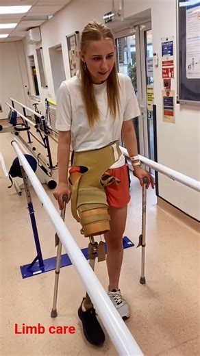 And after 4 years she's walking. Just waiting for my prosthetic leg prescription. #prostheticleg