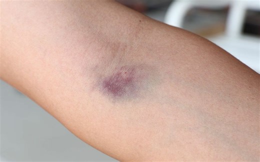 「何かおかしい」性器に血痕、腕には複数の注射跡が…《14歳ドイツ人少女殺害事件》事故死に見せようとした意外すぎる“犯人の正体”とは？（昭和57年・海外の事件） | 文春オンライン