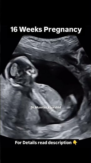 Second Trimester Ultrasound Scan