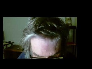 What Is MagicJack And How It Works