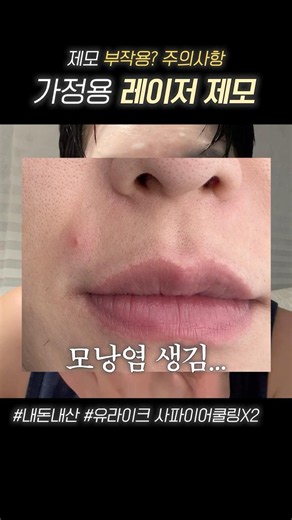 가정용 레이저제모기 부작용? 주의사항 #유라이크 #사파이어쿨링x2 #레이저제모기 #레이저제모부작용 #유라이크제모기 #가정용레이저제모 #가정용레이저제모기 #셀프제모 #남자레이저제모