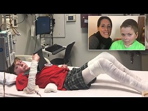 Strangers Raise $100G For Boy With Rare Skin Disease Covered In Burns