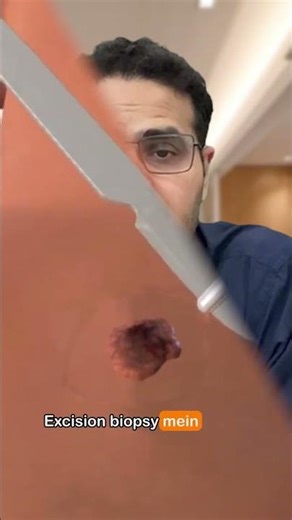 Dr. breaks down the two main types of biopsy: