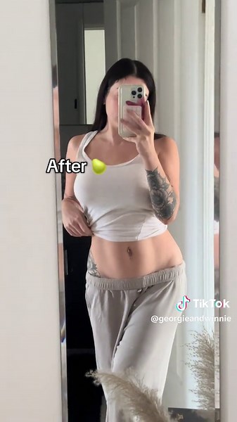 Postpartum Body Transformation: Embracing Change