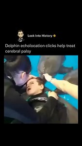 Dolphin sound frequencies—especially their ultrasonic echolocation clicks ranging from around 2,000 Hz to 100,000 Hz—are believed to offer potential therapeutic benefits for children with cerebral palsy. These high-frequency sounds generate subtle vibrations that may influence brain function by promoting relaxation and enhancing neural synchronization between the brain’s hemispheres. This effect is similar to vibroacoustic therapy, which has been shown to help reduce muscle stiffness and improve