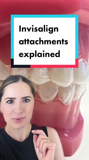 Invisalign Attachments: What are Those Bumps on Teeth?