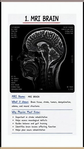 Brain MRI Explained | Common Findings & Interpretation #doctor #mbbs #medicalstudent #MRI #medico