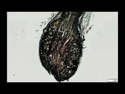 Golgi Apparatus in Neurons (Silver Staining) - PUMS Histology Slides Review Series