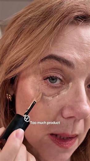 Under-eye bags don’t need surgery—they need the right technique