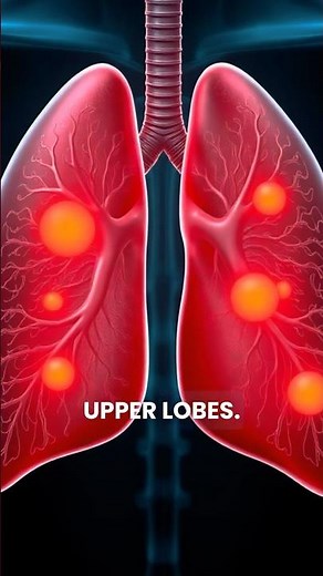 Emphysema Types: You’re Mixing Them Up | #medicaleducation