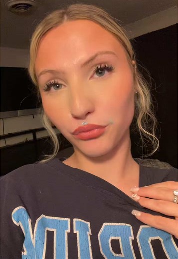 Using Toothpaste for Pimples: Quick Tips