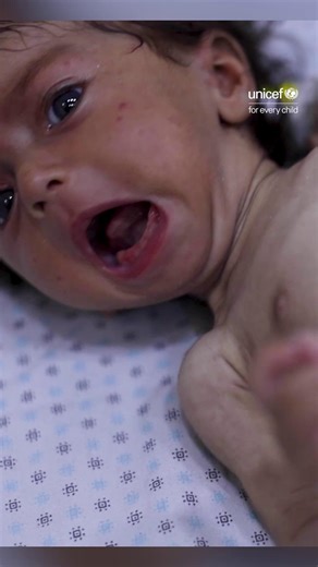 Famine is now a reality in Gaza. A man-made disaster for children and families that we have been warning about. Urgent, large-scale action is needed NOW for children and families. | UNICEF