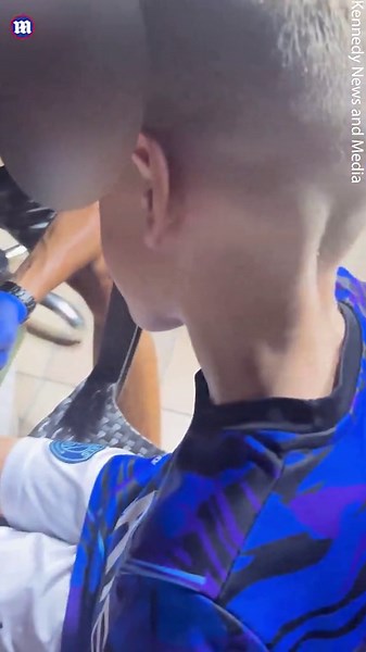 Boy left severely burned after getting henna tattoo in Turkey