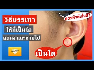 เป็นไตที่หูทำยังไงดี? วิธีบรรเทาให้ที่เป็นไตลดลง และหายไป | เพชร Tips