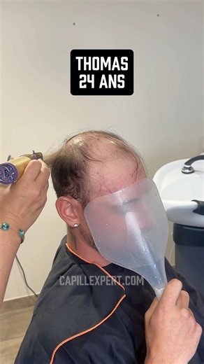 #toupee #toupet #prothesecapillaire