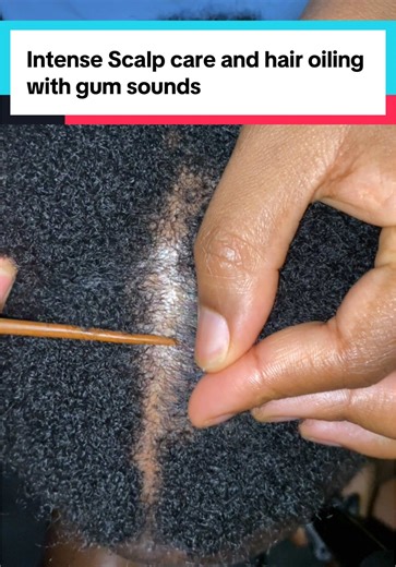 Intense Scalp Care and Hair Oiling Techniques