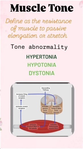 #spasticity #tonicity#flaccidity #physiotherapy #physio #cogwheel rigidity #shorts #ytshorts