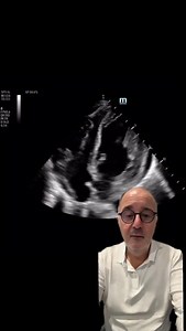 Cas clinique de cardio #santé #médecine #health #médical #cardio #cardiologie #echo #casclinique #endocardite #urgence | Dr Louis Ben Dayan