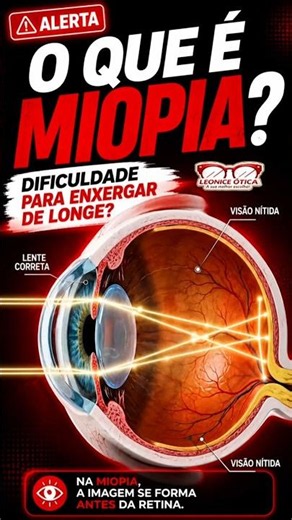 O QUE É MIOPIA? Entenda em Poucos Segundos#CuideDaSuaVisão#ÓculosDeGrau#SaúdeVisual