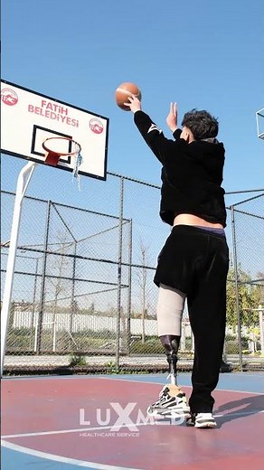 Our below-knee amputee patient's first prosthetic experience