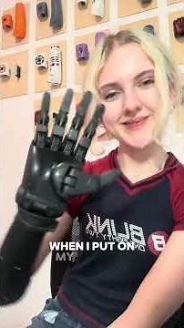 These are what let me control my bionic hand! 👀 🦾 #HeroPRO #explained #l #MyoPods
