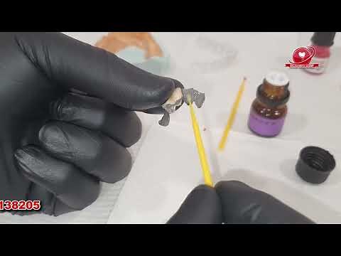 Clinical Demo of How to fix a Maryland Bridge - A Clinical Case study