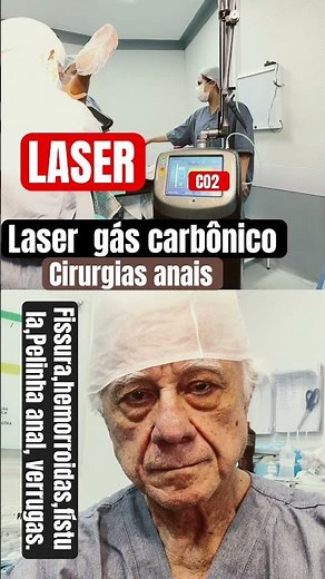 Carbon dioxide laser surgery for anal fissures, fistulas, skin tags, hemorrhoids, and anal warts.