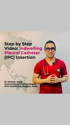 Dr. Sameer Arbat - One Healthcare🫁 on Instagram: "Indwelling Pleural Catheter (IPC) Insertion Video. This step-by-step video outlines the standardized approach to IPC placement for optimal outcomes in managing recurrent pleural effusions. Precision, technique, and patient care are critical in Indwelling Pleural Catheter (IPC) insertion. The video covers the following steps - - Components of an IPC Kit. - 1. Patient preparation. - 2. Sterilisation and Anesthesia. - 3. Establishing Pleural