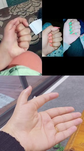 Unique 6-Fingered TikTok Sensation from India and New Zealand