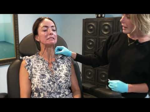 Nefertiti Neck Lift by Refine Med Spa