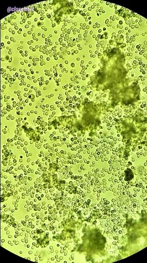 Activating Yeast Cells Under Microscope
