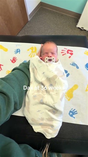 Dax was a preemie baby born at 34 weeks