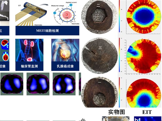 电阻抗成像, 电阻抗断层成像（EIT）硬件设备