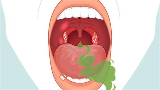 How to check your mouth for cancer - from bad breath tests to wobbling teeth