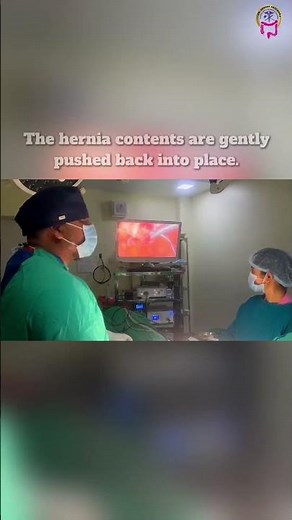 Here’s how we repair incisional hernia using Laparoscopic surgery! | #hernia #herniasurgery #shorts