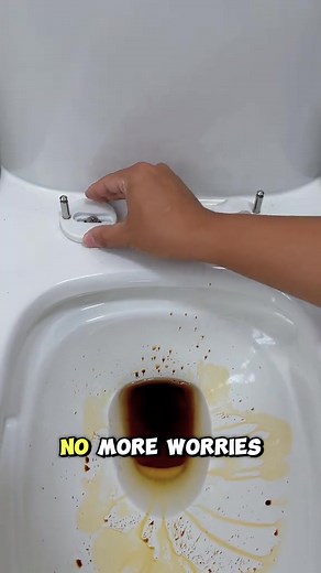 🔩 Universal Toilet Seat Bolt Kit—Fix & Replace in Minutes! Tired of loose or broken toilet seat screws? This universal kit fits most toilet seats, making repairs quick and hassle-free. ✅ Universal fit for standard toilets ✅ Durable, rust-resistant screws ✅ Easy to install (no special tools needed) Skip the hardware store run—get your toilet seat secure again! 🛠️ | Distceinthe