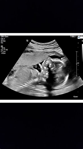 Kelsey James on TikTok