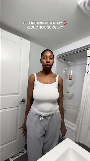 I got a Breast Reduction | Before and After Results 💗 #selfcare #postop #breastreductionsurgery