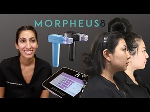 Non-Invasive Neck Tightening w/ Morpheus8