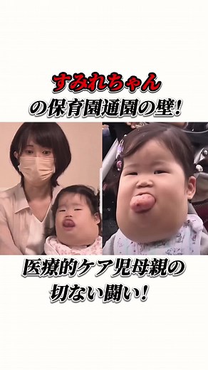 すみれちゃんの医療的ケアと保育園通園