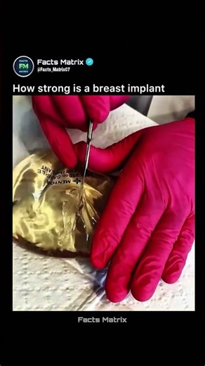 How Strong Is a Breast Implant? 🧪 | Strength Test Explained #shorts #information #knowledge