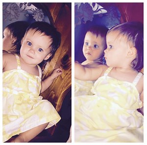 Baby burned in gas can explosion to undergo 10-hour surgery