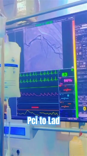 cathlab procedure ❤️PTCA TO LAD#ytshorts #cathlab #technician #trending #shortvideo #cardiology