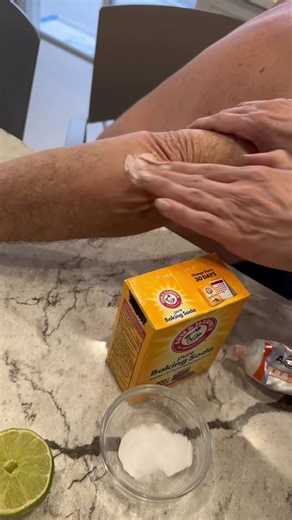 #onthisday #calluses #feet #elbow | feet massage machine