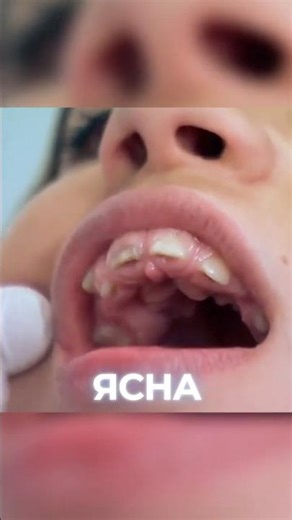 😲ЩО СТАЛОСЯ з героїнею "Я соромлюсь свого тіла"? #shorts