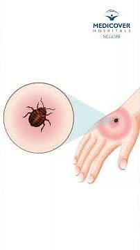 Scrub Typhus Explained | Causes, Symptoms & Treatment | Dr. P. Vijaya Kumar