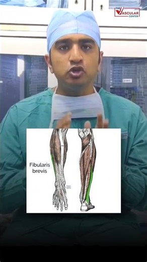 (Deep Vein Thrombosis) DVT कब और क्यों होता है?