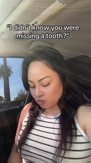 Understanding Tooth Loss and Dentures